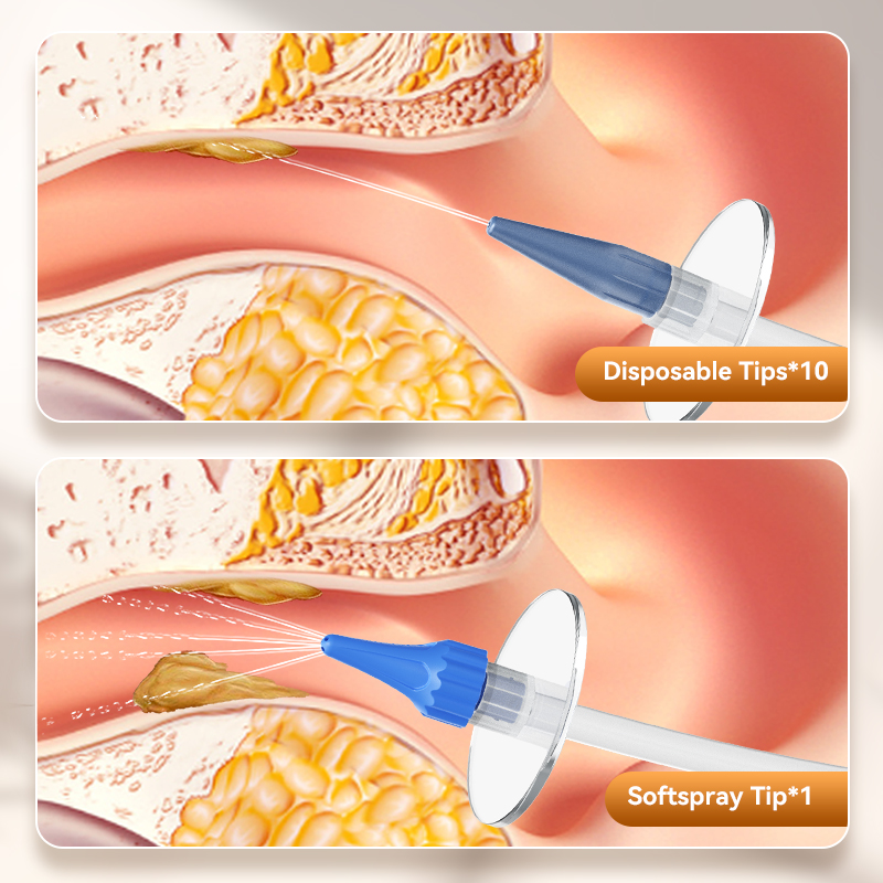 Ear Wax Removal Manual Ear Irr - Smart Garden Watering System review and price